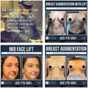 Seattle Plastic Surgery logo